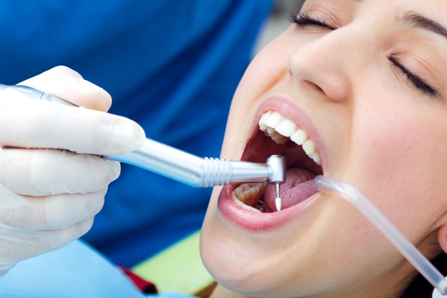 Endodontics (Root Canal Treatment)